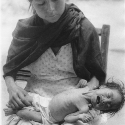 A very sick baby